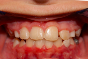 Orthodontics Topeka
