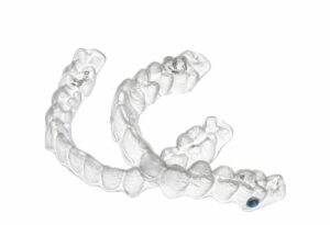 The Different Types of Braces