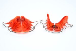 Everything You Need to Know About Palatal Expanders